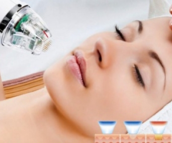 ĐIỀU TRỊ SẸO RỔ BẰNG CÔNG NGHỆ RF BENEFITS SIÊU VI ĐIỂM KẾT HỢP CÔNG NGHỆ LASER